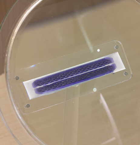 Endo Reload with Absorbable Reinforcement