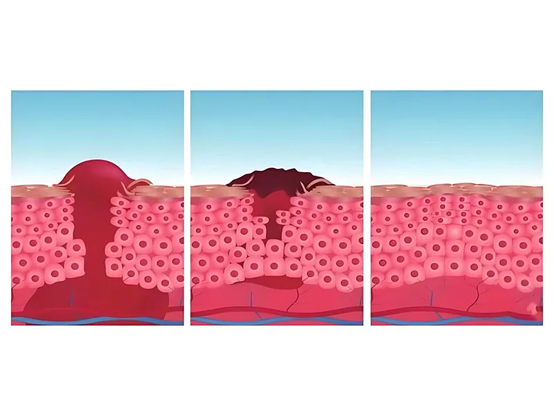 Scientifically Matches Tissue Healing