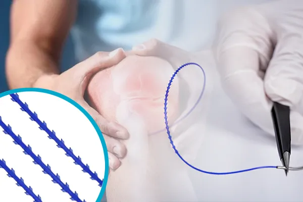 Why the Knee Joint May Be the Most Demanding Closure Environment a Surgical Suture Will Ever Face